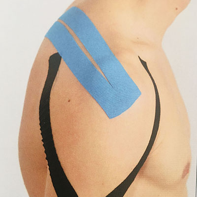 applicazione taping spalla